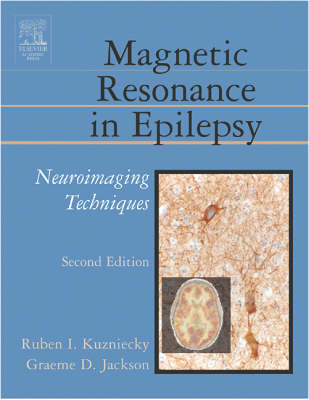 Magnetic Resonance in Epilepsy Second Edition | Zookal Textbooks | Zookal Textbooks