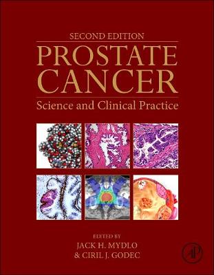 Prostate Cancer 2e: Science and Clinical Practice | Zookal Textbooks | Zookal Textbooks