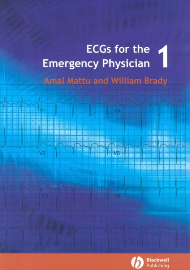 ECGs for the Emergency Physician 1 | Zookal Textbooks | Zookal Textbooks