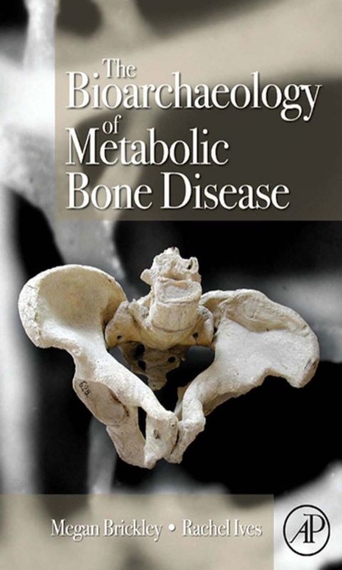 The Bioarchaeology of Metabolic Bone Disease | Zookal Textbooks | Zookal Textbooks