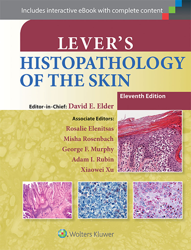 Lever's Histopathology of the Skin | Zookal Textbooks | Zookal Textbooks