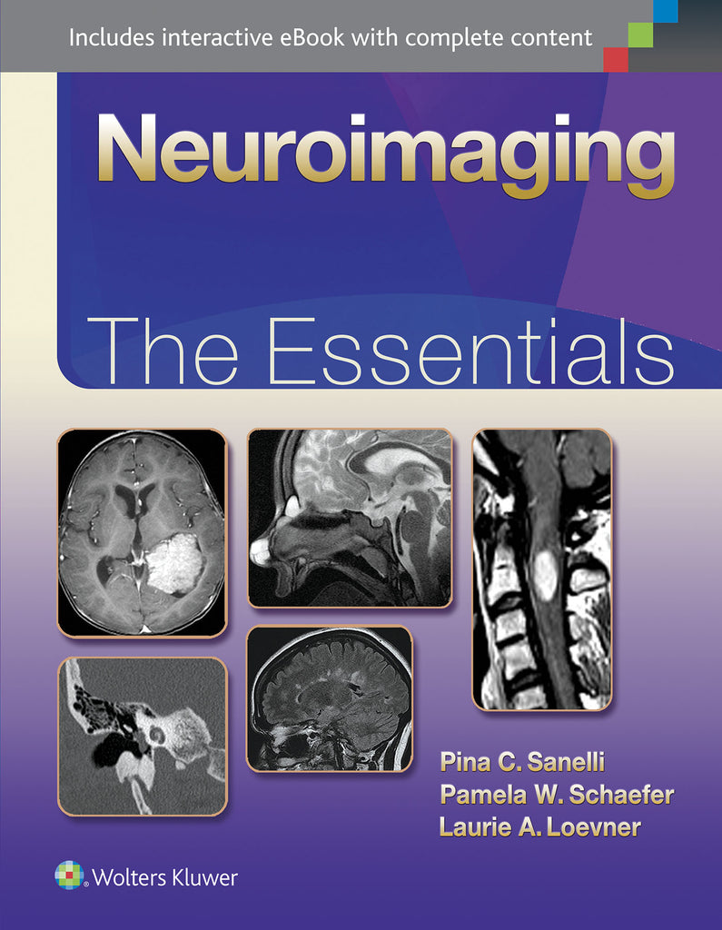 Neuroimaging: The Essentials | Zookal Textbooks | Zookal Textbooks