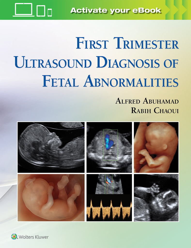 First Trimester Ultrasound Diagnosis of Fetal Abnormalities | Zookal Textbooks | Zookal Textbooks