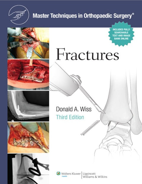 Master Techniques in Orthopaedic Surgery: Fractures | Zookal Textbooks | Zookal Textbooks