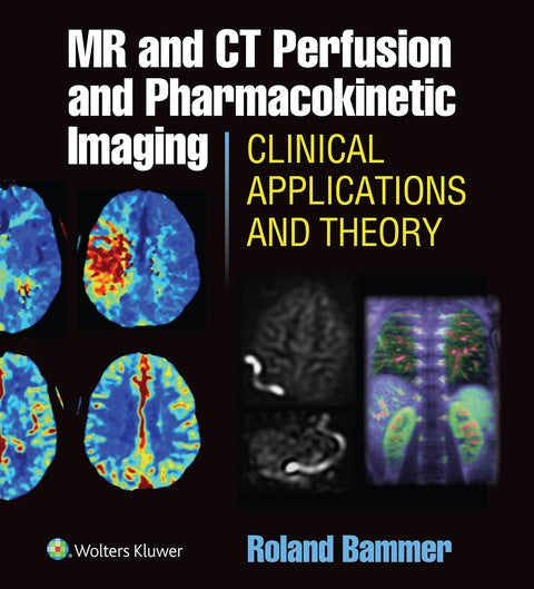 MR and CT Perfusion and Pharmacokinetic Imaging: Clinical Applications and Theoretical Principles | Zookal Textbooks | Zookal Textbooks