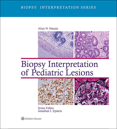 Biopsy Interpretation of Pediatric Lesions | Zookal Textbooks | Zookal Textbooks