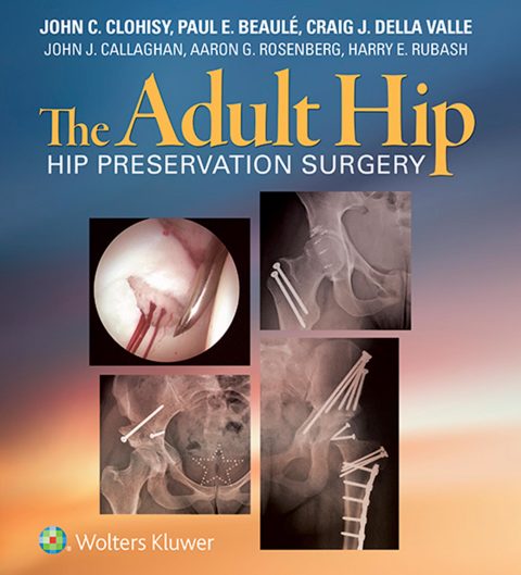 The Adult Hip | Zookal Textbooks | Zookal Textbooks