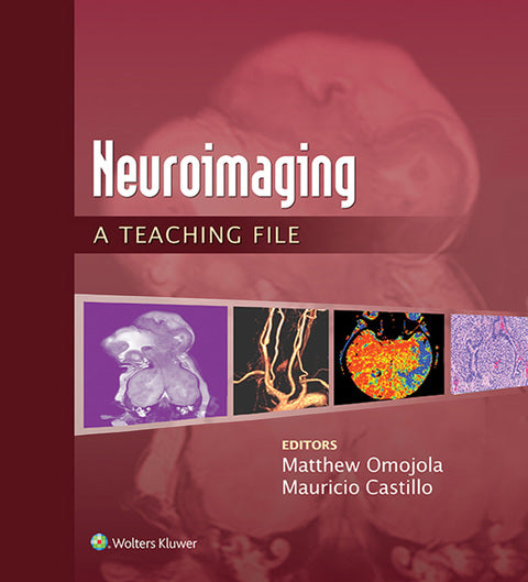 Neuroimaging: A Teaching File | Zookal Textbooks | Zookal Textbooks