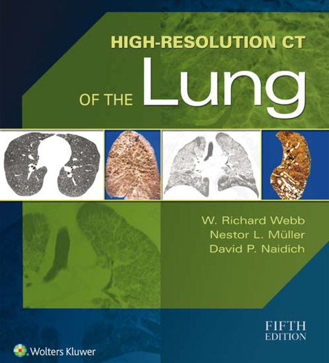 High-Resolution CT of the Lung | Zookal Textbooks | Zookal Textbooks