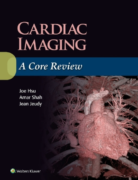 Cardiac Imaging: A Core Review | Zookal Textbooks | Zookal Textbooks