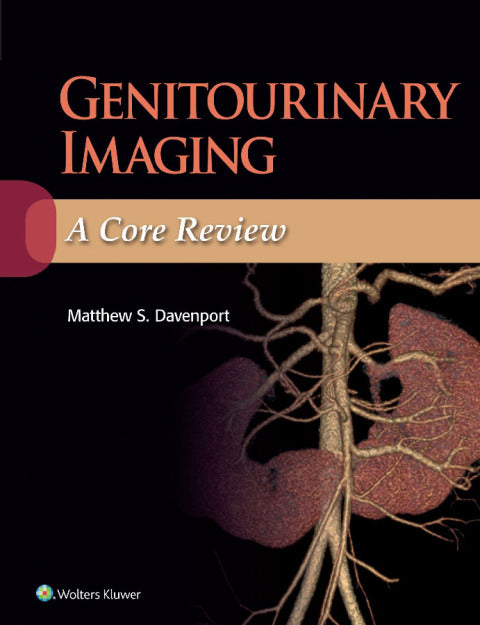 Genitourinary Imaging: A Core Review | Zookal Textbooks | Zookal Textbooks