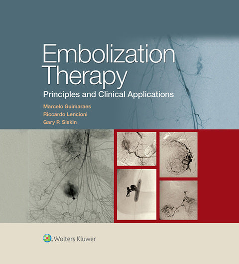 Embolization Therapy: Principles and Clinical Applications | Zookal Textbooks | Zookal Textbooks