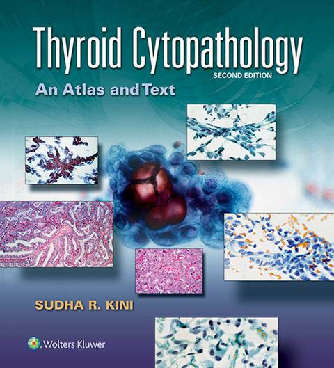 Thyroid Cytopathology | Zookal Textbooks | Zookal Textbooks