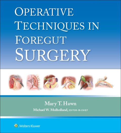 Operative Techniques in Foregut Surgery | Zookal Textbooks | Zookal Textbooks