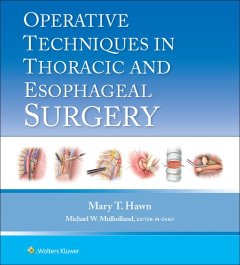 Operative Techniques in Thoracic and Esophageal Surgery | Zookal Textbooks | Zookal Textbooks