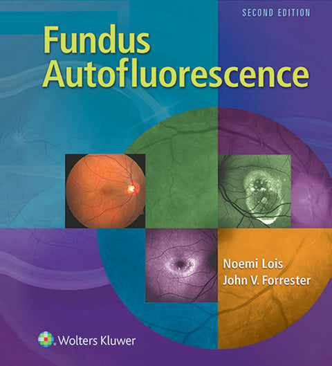 Fundus Autofluorescence | Zookal Textbooks | Zookal Textbooks