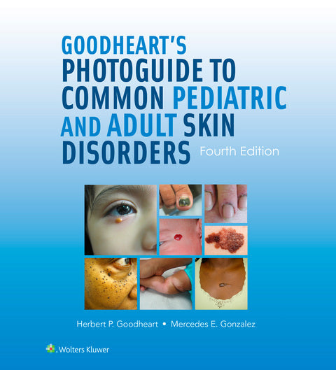 Goodheart's Photoguide to Common Pediatric and Adult Skin Disorders | Zookal Textbooks | Zookal Textbooks