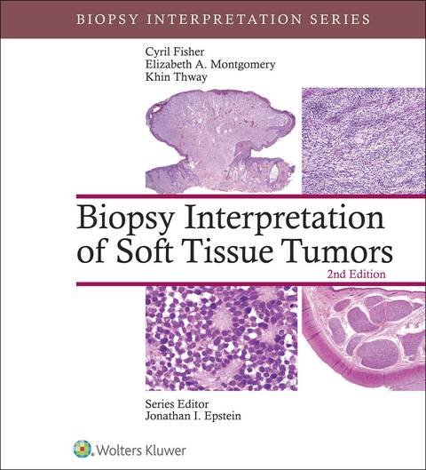 Biopsy Interpretation of Soft Tissue Tumors | Zookal Textbooks | Zookal Textbooks