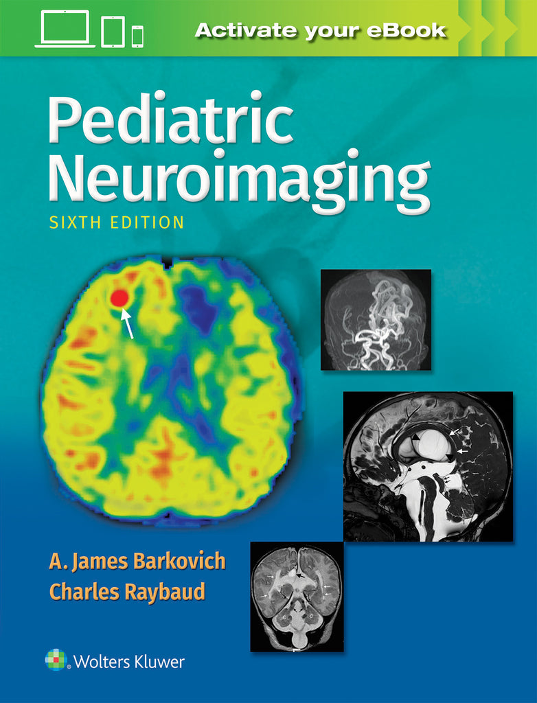 Pediatric Neuroimaging | Zookal Textbooks | Zookal Textbooks