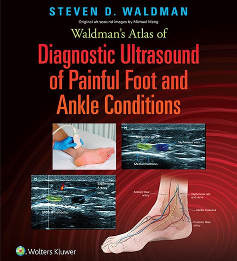 Waldman's Atlas of Diagnostic Ultrasound of Painful Foot and Ankle Conditions | Zookal Textbooks | Zookal Textbooks