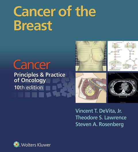 Cancer of the Breast | Zookal Textbooks | Zookal Textbooks