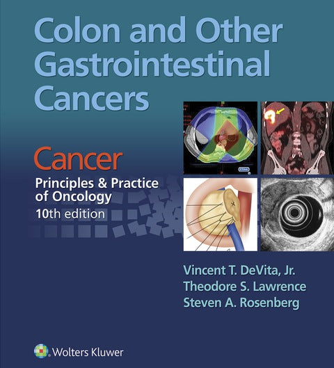 Colon and Other Gastrointestinal Cancers | Zookal Textbooks | Zookal Textbooks