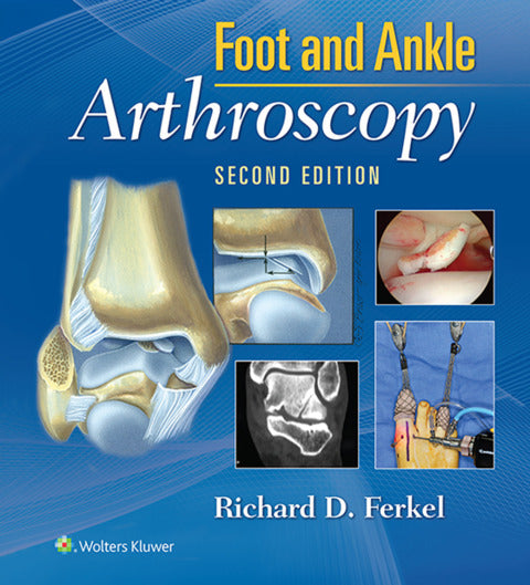 Foot & Ankle Arthroscopy | Zookal Textbooks | Zookal Textbooks