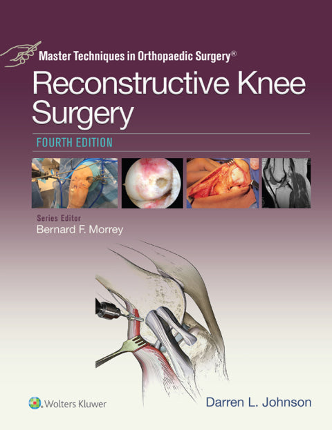 Master Techniques in Orthopaedic Surgery: Reconstructive Knee Surgery | Zookal Textbooks | Zookal Textbooks