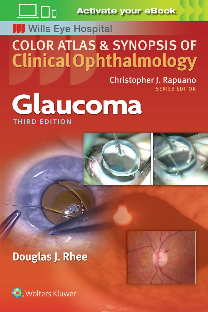 Color Atlas and Synopsis of Clinical Ophthalmology - Glaucoma | Zookal Textbooks | Zookal Textbooks