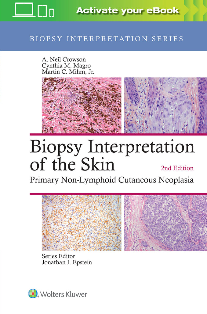 Biopsy Interpretation of the Skin | Zookal Textbooks | Zookal Textbooks
