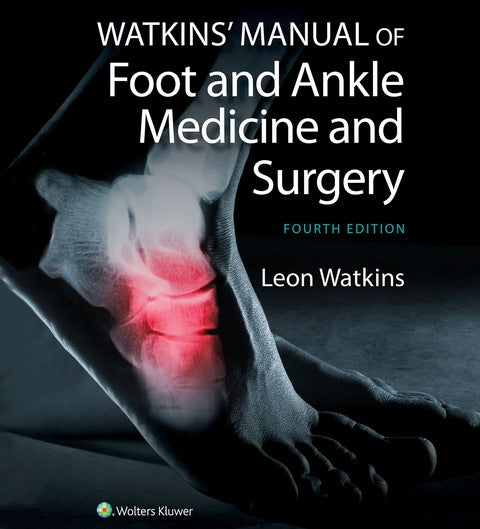 Watkins' Manual of Foot and Ankle Medicine and Surgery | Zookal Textbooks | Zookal Textbooks