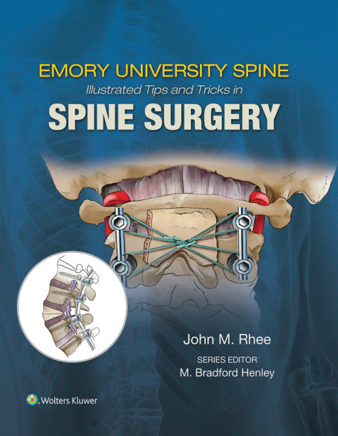 Emory's Illustrated Tips and Tricks in Spine Surgery | Zookal Textbooks | Zookal Textbooks