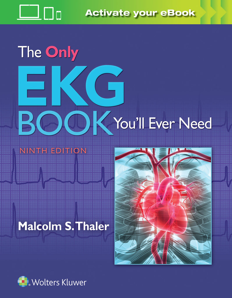 The Only EKG Book You'll Ever Need | Zookal Textbooks | Zookal Textbooks