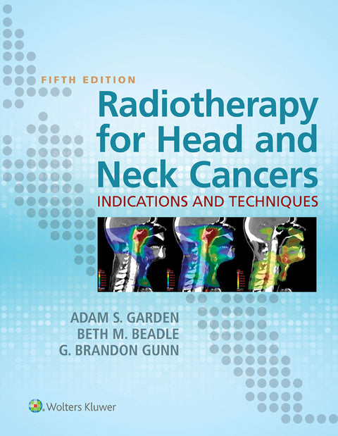 Radiotherapy for Head and Neck Cancers: Indications and Techniques | Zookal Textbooks | Zookal Textbooks