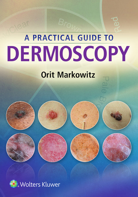 A Practical Guide to Dermoscopy | Zookal Textbooks | Zookal Textbooks