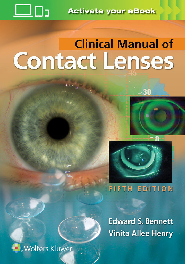 Clinical Manual of Contact Lenses | Zookal Textbooks | Zookal Textbooks