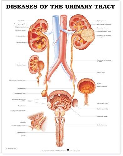 Diseases of the Urinary Tract Anatomical Chart Paper Unmounted | Zookal Textbooks | Zookal Textbooks
