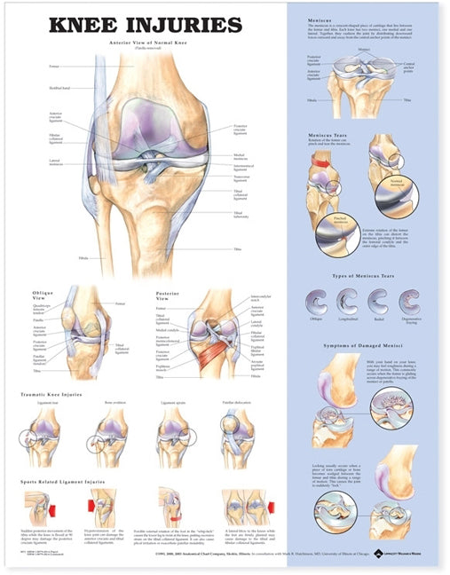 Knee Injuries Anatomical Chart Paper Unmounted | Zookal Textbooks | Zookal Textbooks