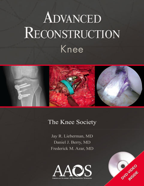 Advanced Reconstruction: Knee | Zookal Textbooks | Zookal Textbooks