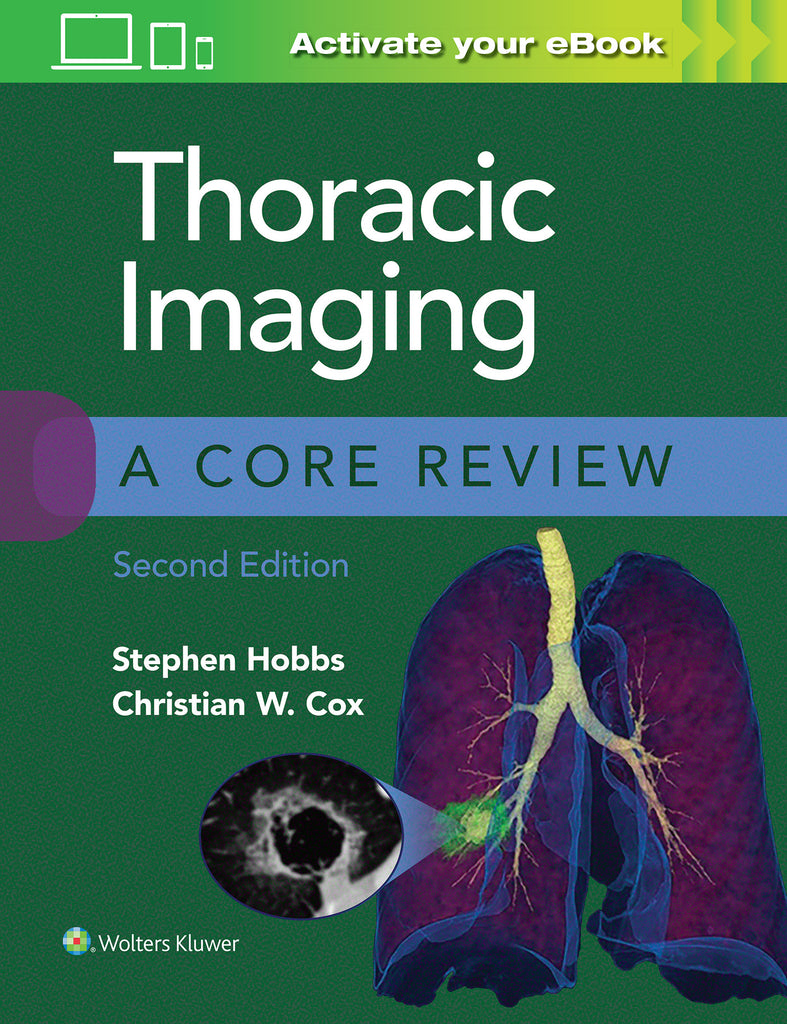 Thoracic Imaging: A Core Review | Zookal Textbooks | Zookal Textbooks