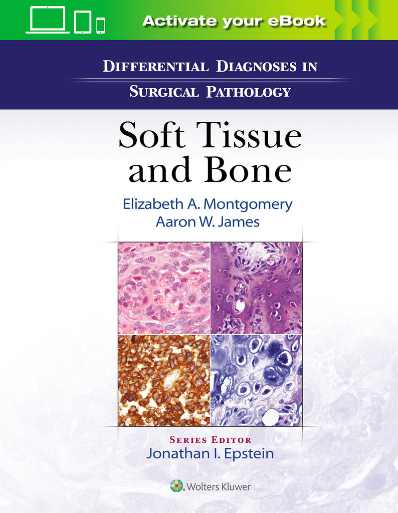 Differential Diagnoses in Surgical Pathology: Soft Tissue and   Bone | Zookal Textbooks | Zookal Textbooks