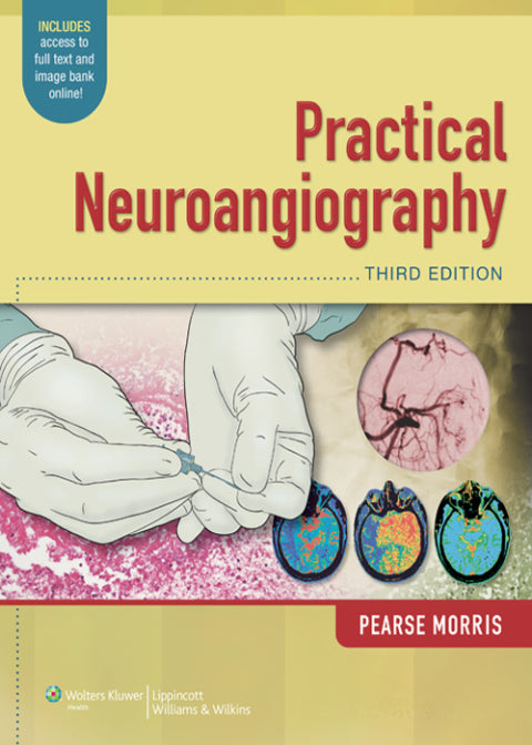 Practical Neuroangiography | Zookal Textbooks | Zookal Textbooks