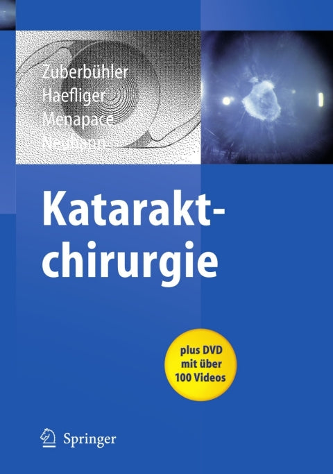 Kataraktchirurgie | Zookal Textbooks | Zookal Textbooks