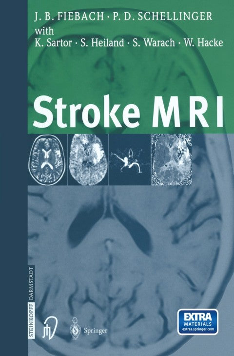 Stroke MRI | Zookal Textbooks | Zookal Textbooks