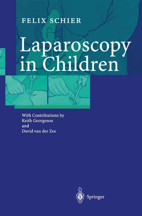 Laparoscopy in Children | Zookal Textbooks | Zookal Textbooks