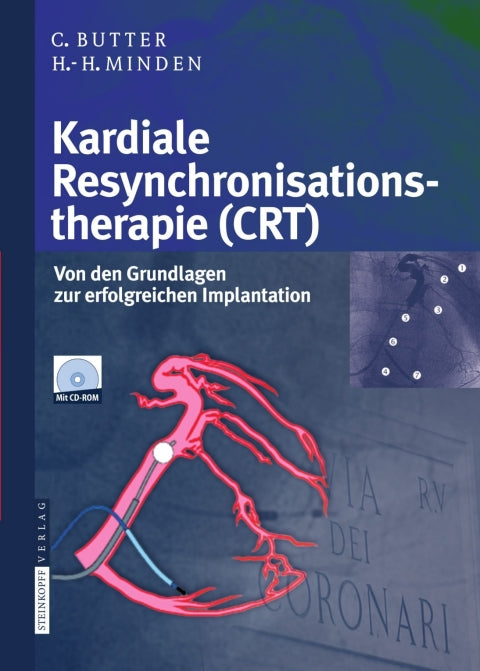 Kardiale Resynchronisationstherapie (CRT) | Zookal Textbooks | Zookal Textbooks